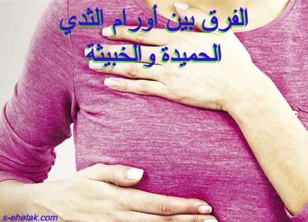 الفرق بين أورام الثدي الحميدة والخبيثة صحتك