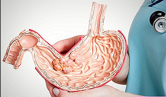 أمراض المعدة .. الأعراض والأسباب
