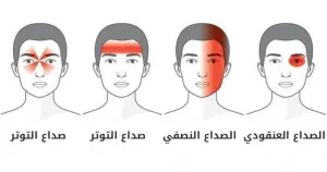 أنواع الصداع وأسبابه وعلاجه أنواع الصداع وأسبابه وعلاجه