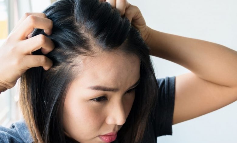 زراعة الشعر في مقدمة الرأس للنساء