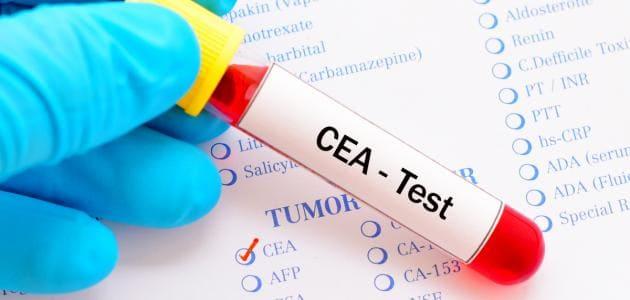 ﺗﺣﻠﯾل cea ﺗﺣﻠﯾل cea