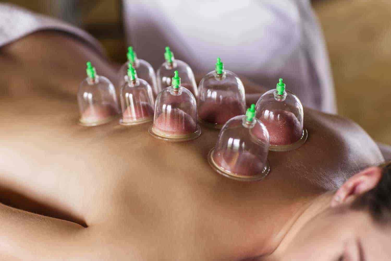 فوائد الحجامة للرجال فوائد الحجامة للرجال