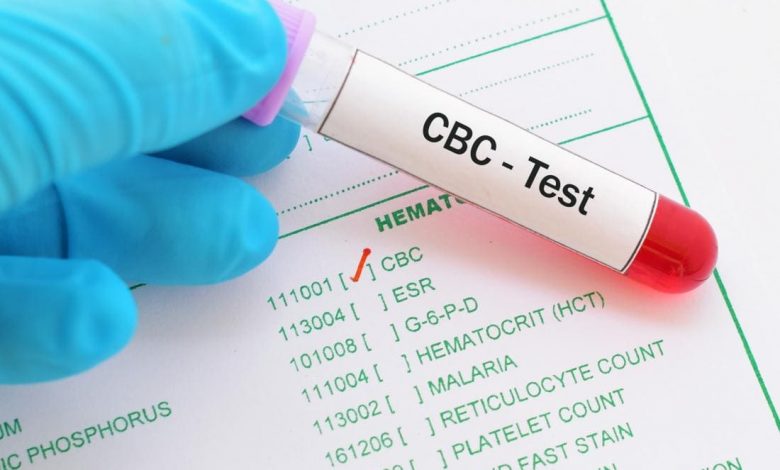 هل تحليل cbc يكشف سرطان الغدد اللمفاوية؟