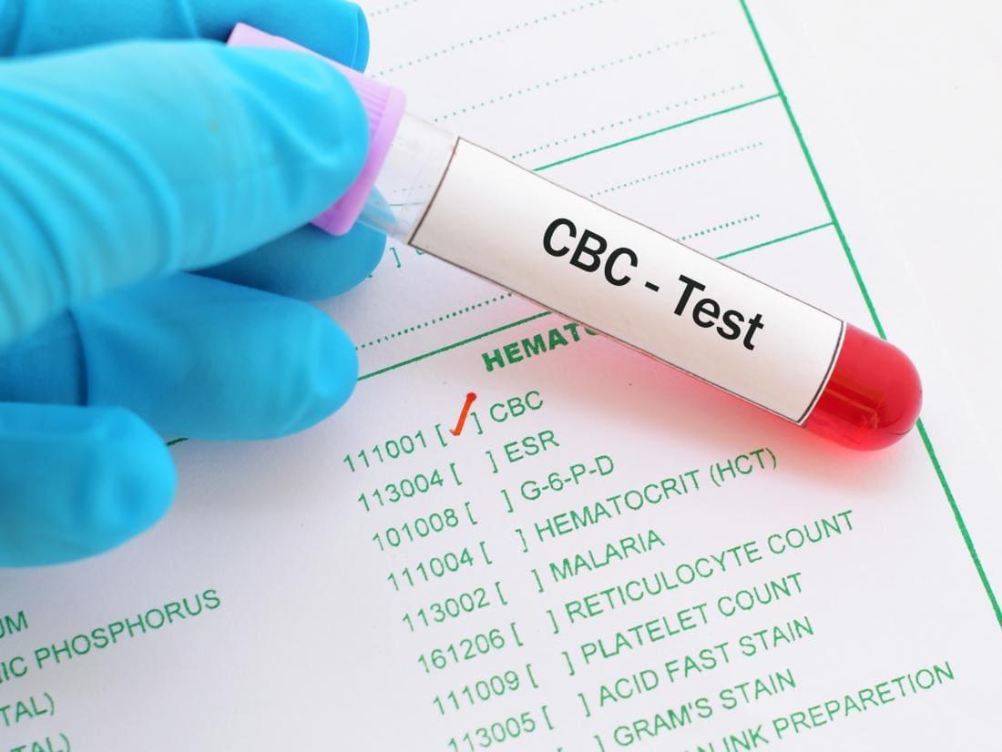 هل تحليل cbc يكشف سرطان الغدد اللمفاوية؟ هل تحليل cbc يكشف سرطان الغدد اللمفاوية؟