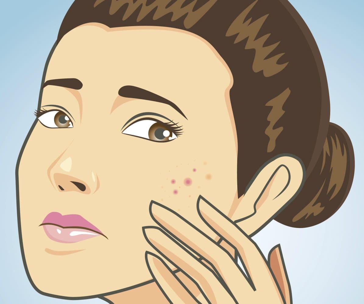 طرق علاج خراج تحت الجلد بدون رأس طرق علاج خراج تحت الجلد بدون رأس