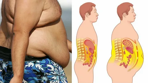 كيف اتخلص من السمنة كيف اتخلص من السمنة