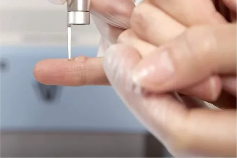 علاج الثالول من الصيدلية النهدي علاج الثالول من الصيدلية النهدي