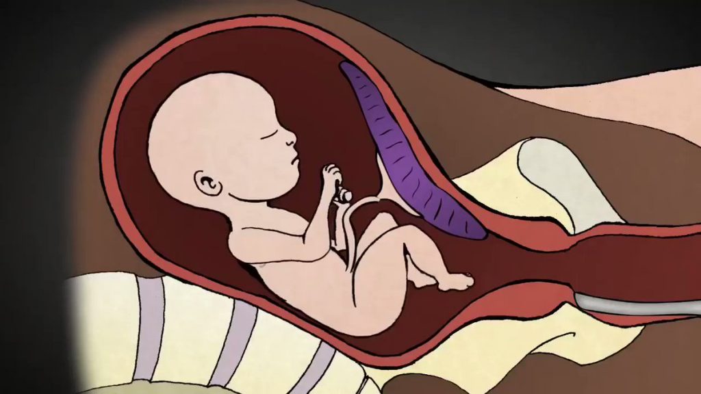 متى يبدأ مفعول الكمون للإجهاض متى يبدأ مفعول الكمون للإجهاض