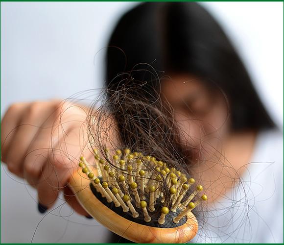 علاج تساقط الشعر في الإمارات